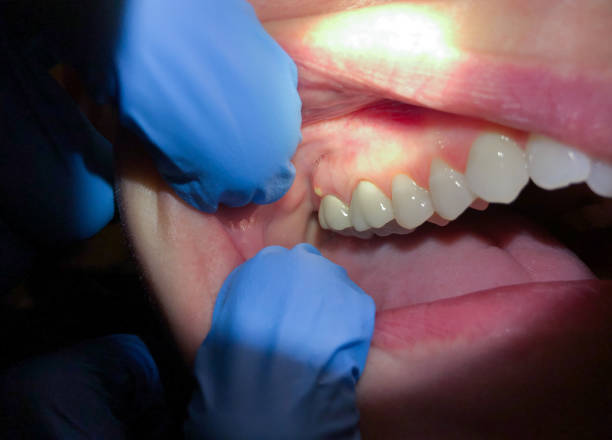 Best Emergency Treatment for Jaw Pain or Injury in Randallstown, MD
