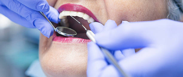 Best Knocked-Out Tooth (Avulsed Tooth) Treatment in Randallstown, MD